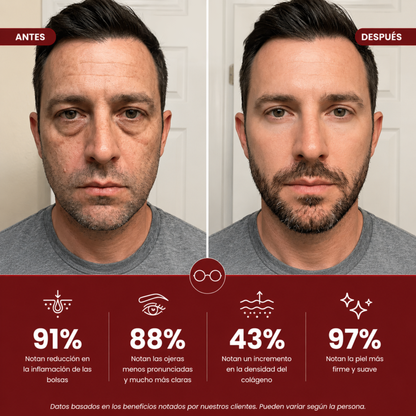LumiEyes™ — Lentes Anti Bolsas y Ojeras