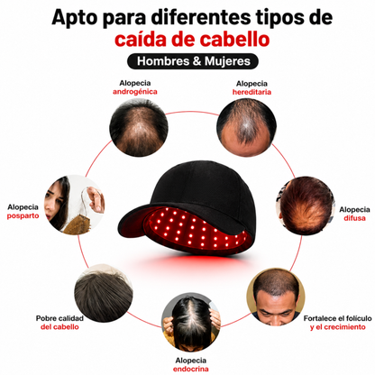 FolluxCap™ — Gorra de Regeneración Capilar