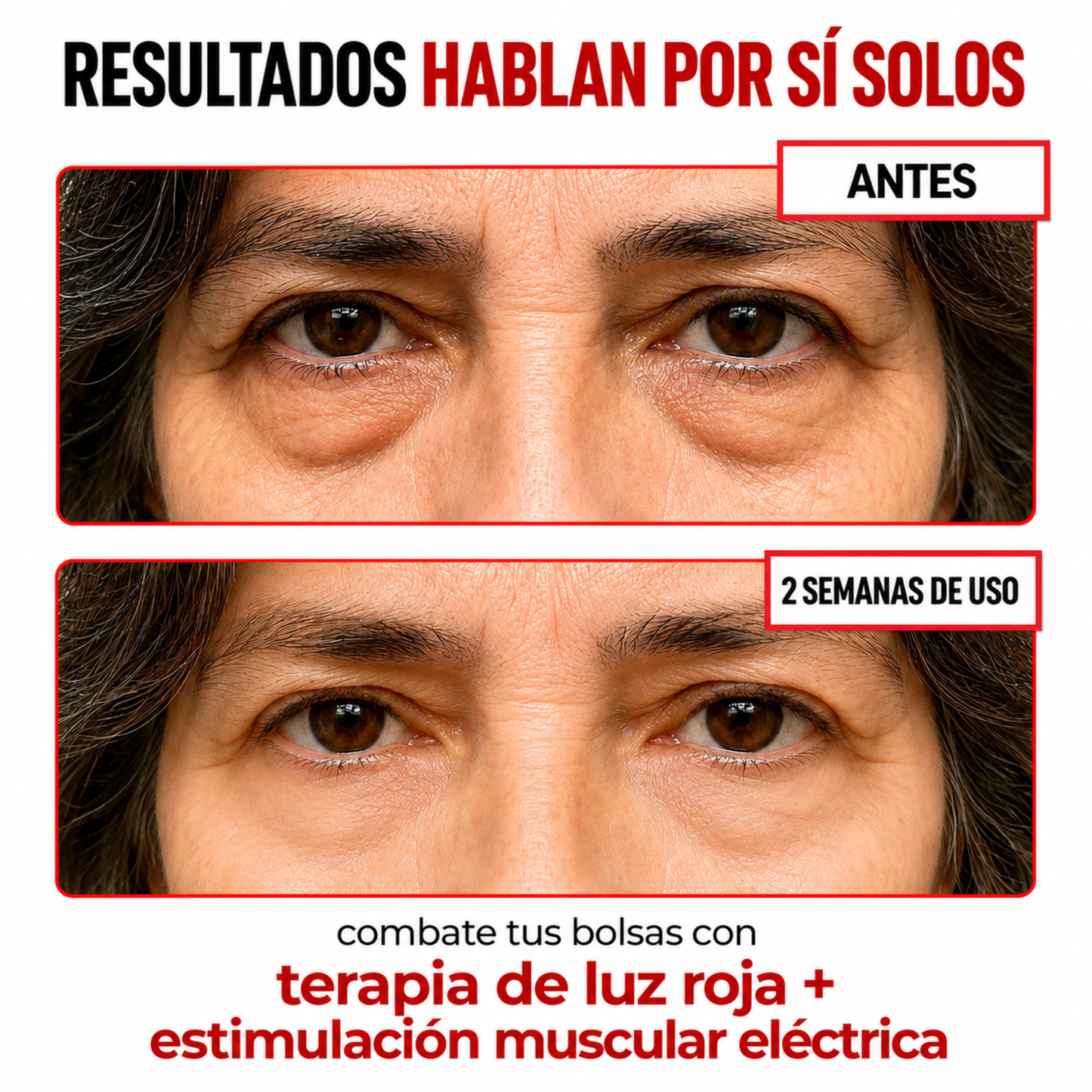 LumiEyes™ — Lentes Anti Bolsas y Ojeras