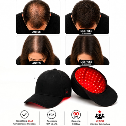 FolluxCap™ — Gorra de Regeneración Capilar