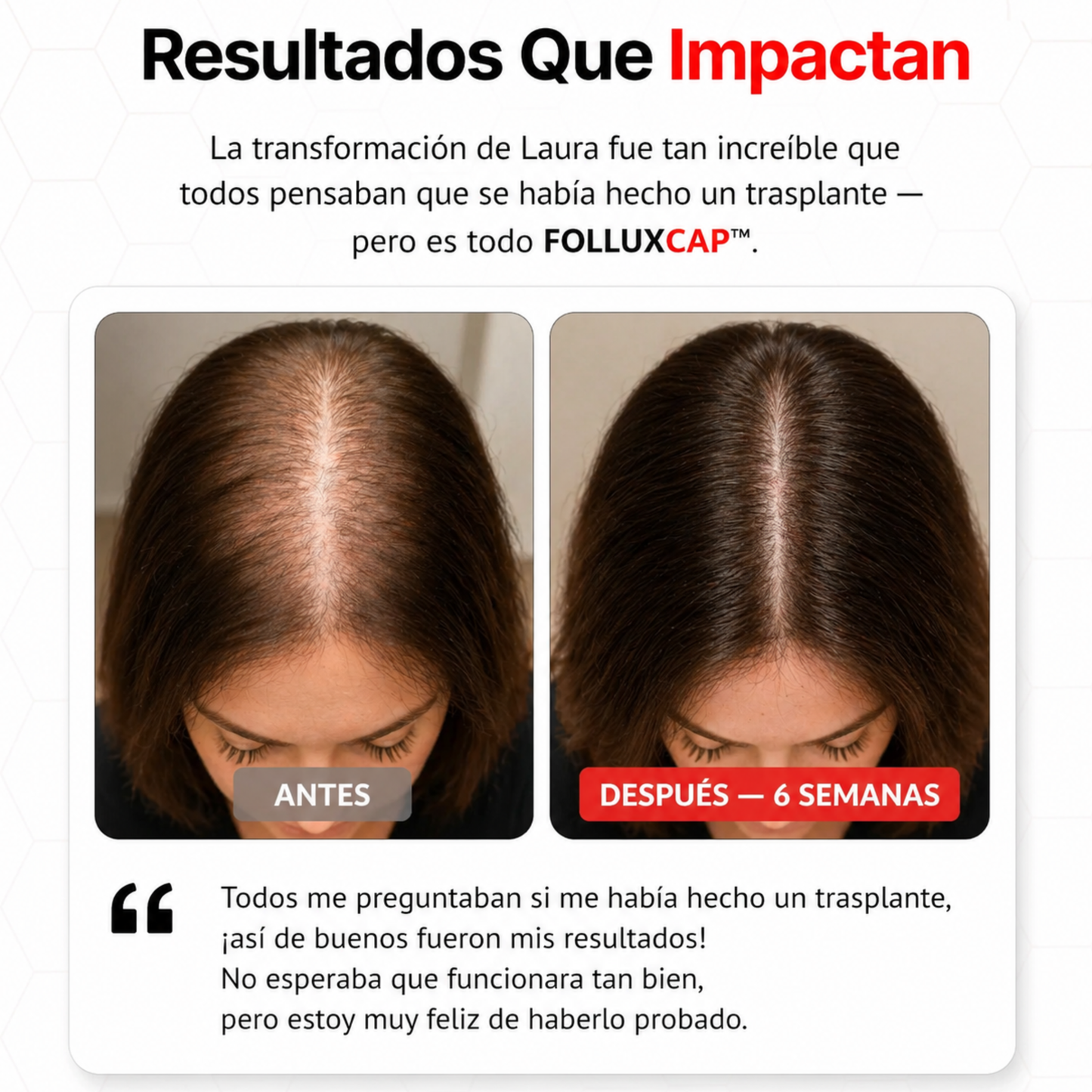 FolluxCap™ — Gorra de Regeneración Capilar