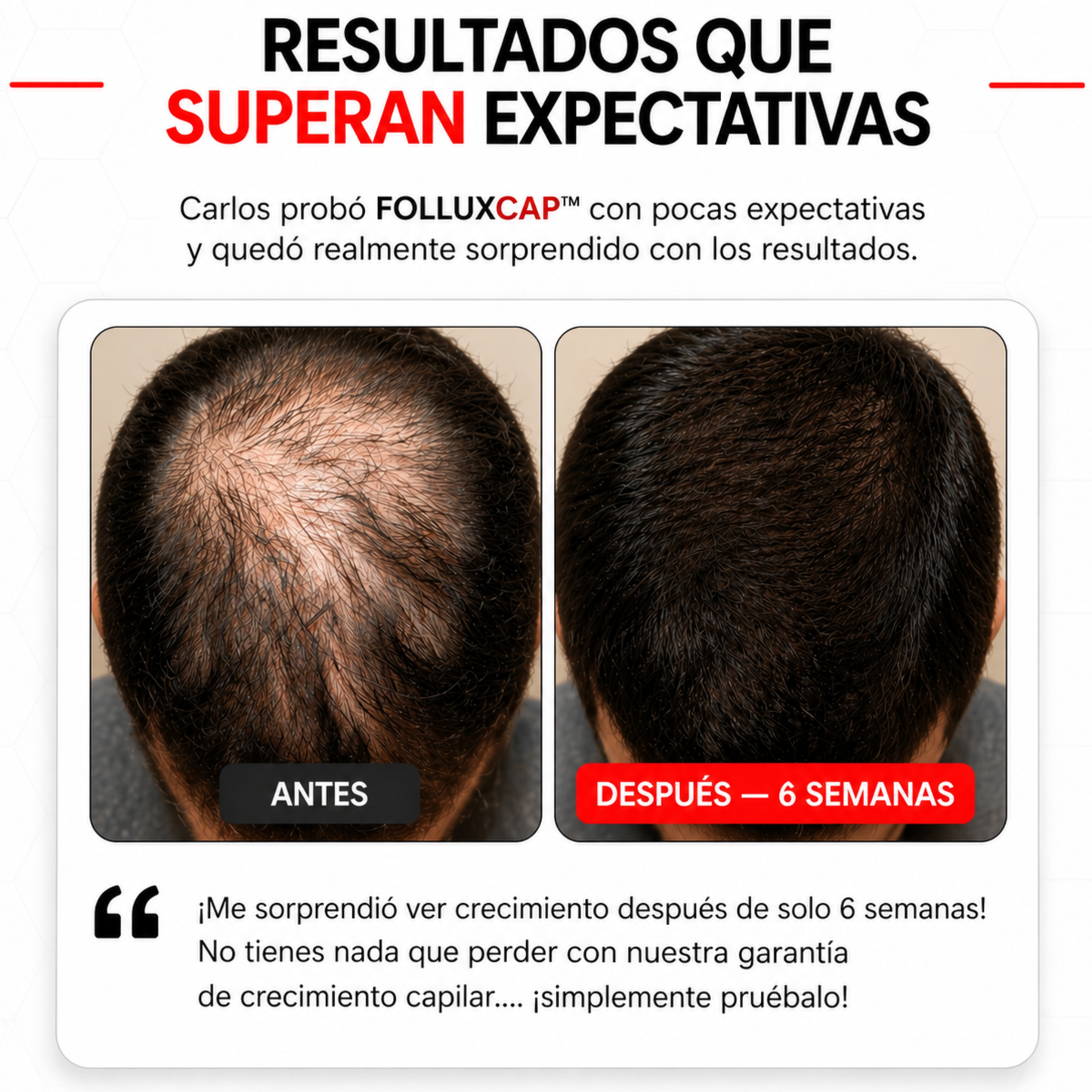 FolluxCap™ — Gorra de Regeneración Capilar