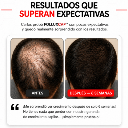 FolluxCap™ — Gorra de Regeneración Capilar