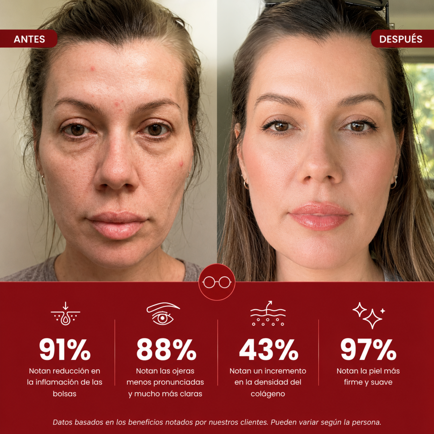 LumiEyes™ — Lentes Anti Bolsas y Ojeras