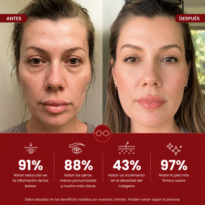 LumiEyes™ — Lentes Anti Bolsas y Ojeras